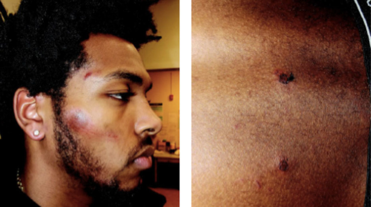 sterling_brown_injuries_embed_.jpg